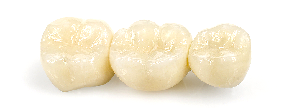 セラミックのブリッジ